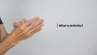 How to Prevent Arthritis: Expert Insights and Proven Strategies